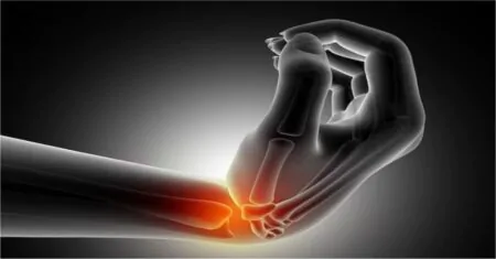 Glucosamine Sulfate for Arthritis | Comprehensive Guide